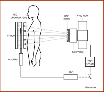  ,   AEC Sensor